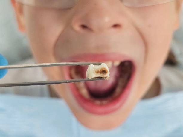 Best Walk-In Emergency Dentist in Texkana, AR